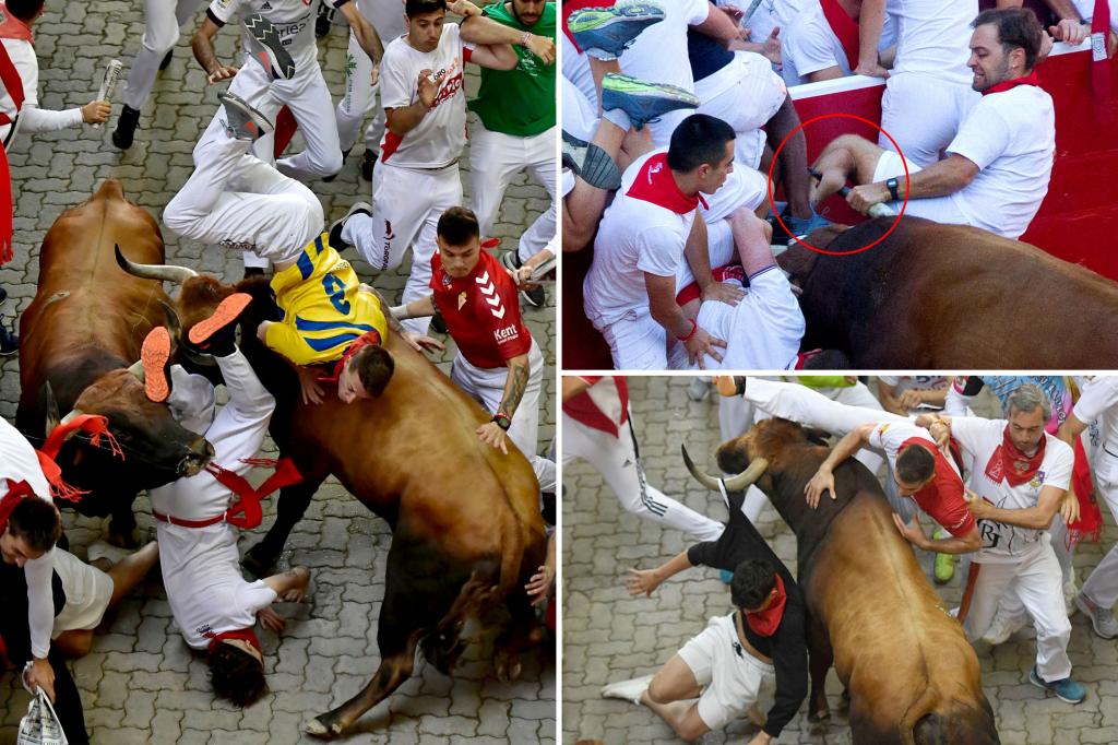 Fotos chocantes mostram a perna rasgada de um homem da Flórida em uma corrida de touros em Pamplona